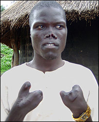 LRA victim, John Ochola